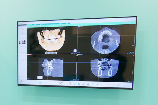 歯科用CT