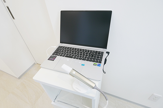 3D光学スキャナー