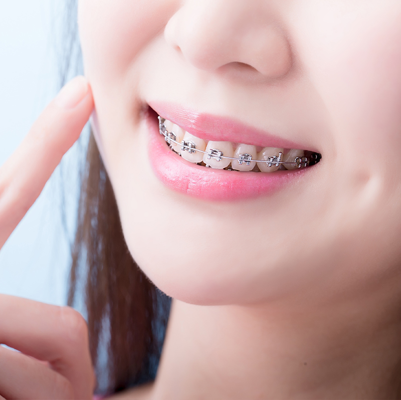 矯正歯科・小児矯正歯科