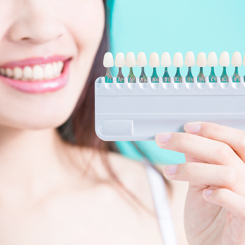 ホワイトニング